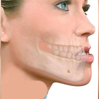 اصلاح ناهنجاریهای فک و صورت در بزرگسالان دکتر خلیل عباسی