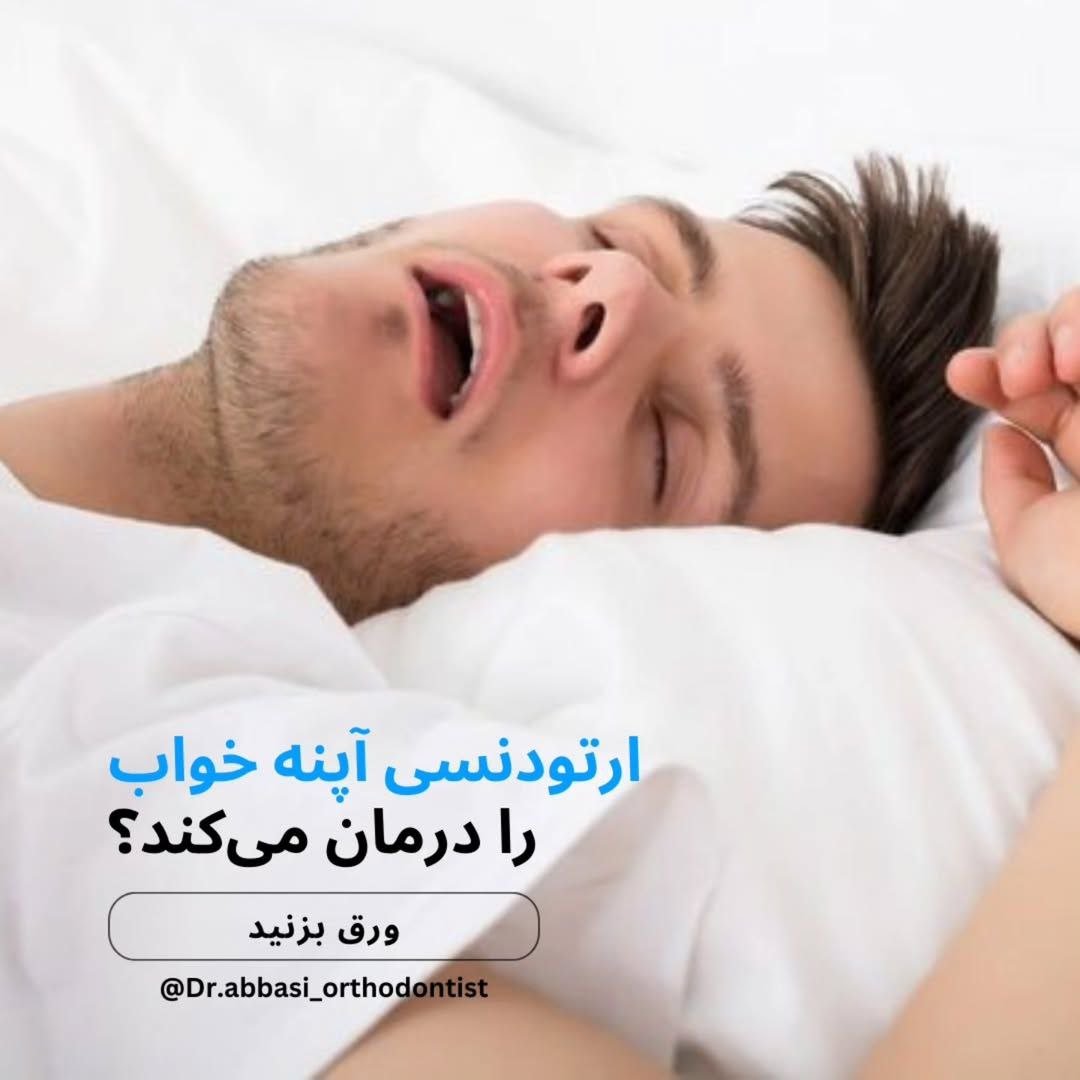 آپنه خواب و ارتودنسی