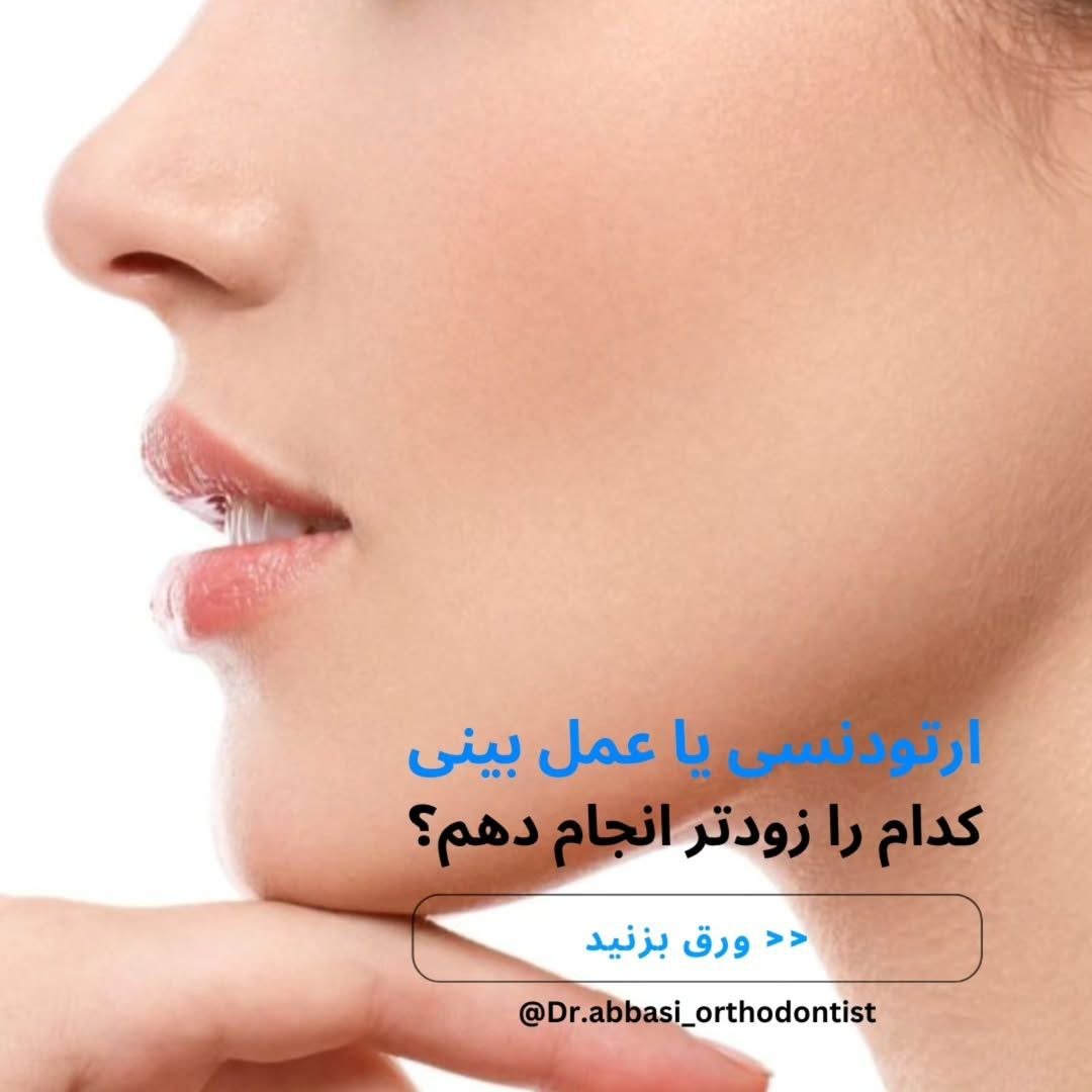 ارتودنسی یا عمل بینی