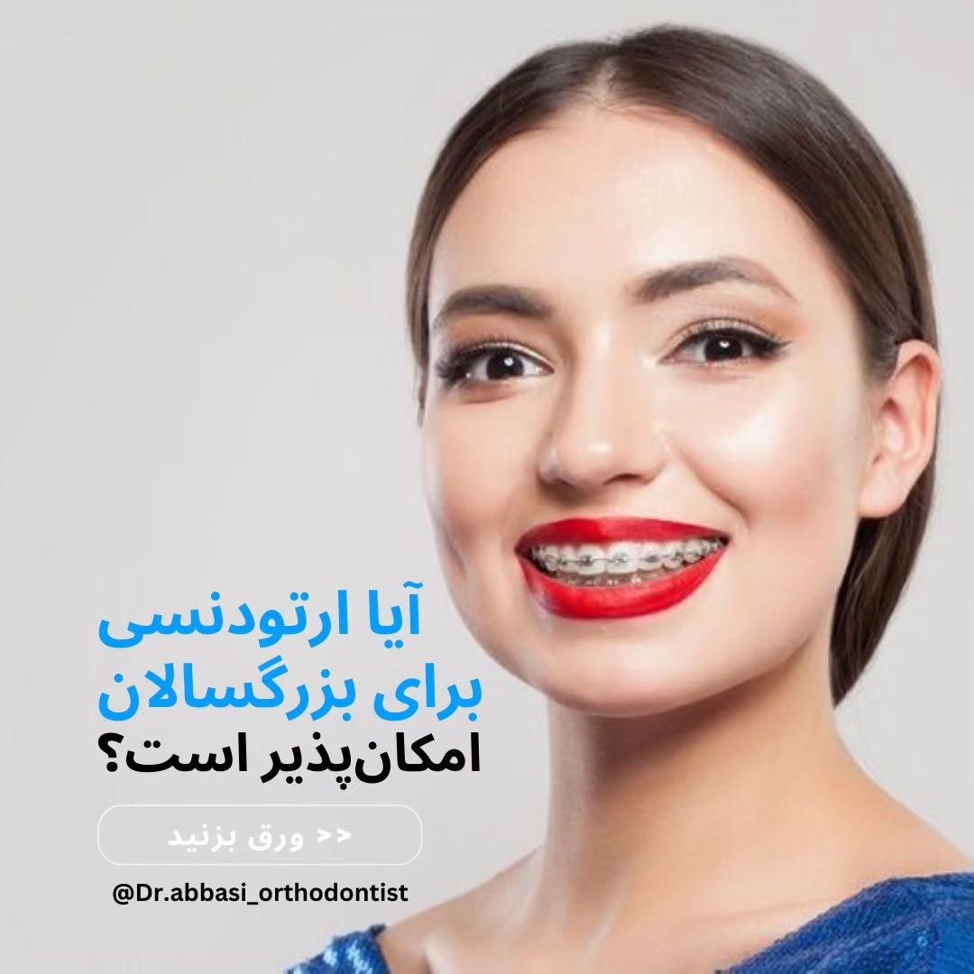 ارتودنسی برای بزرگسالان